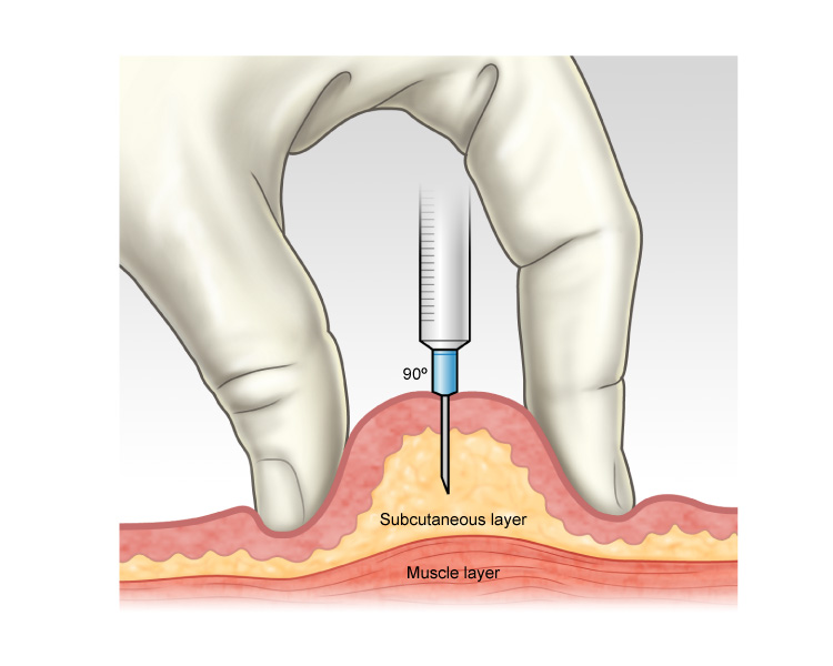 Nursing skill image